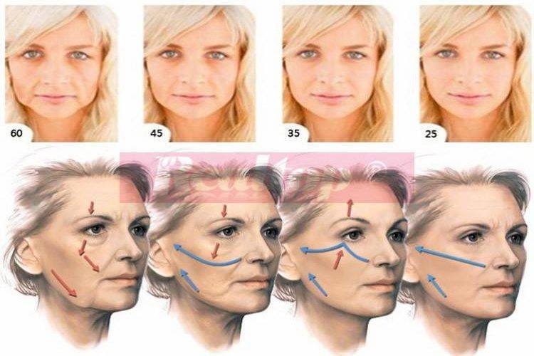 Lifting facial Hifu Brasov